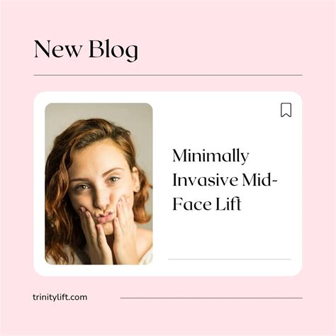 Minimally Invasive Mid-Face Lift - Trinity Lift