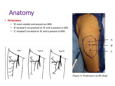 Anterolateral Thigh Flap