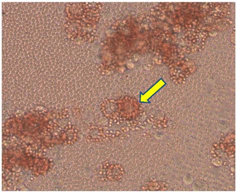 Viability of African Swine Fever Virus with the Shallow Burial with ...