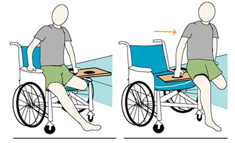Prosthetics Information for paitent