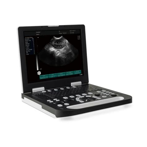 Veterinary Ultrasound Machine For Livestock & Pet Clinic