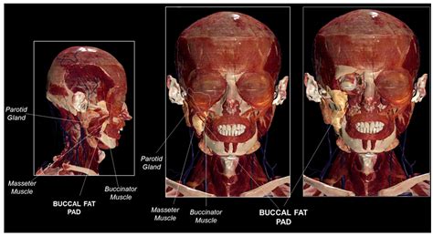 The Buccal Fat Pad: A Unique Human Anatomical Structure and Rich and Easily Accessible Source of ...