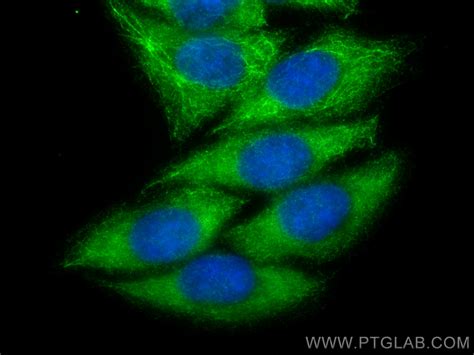 FBXO17 antibody (12844-1-AP) | Proteintech