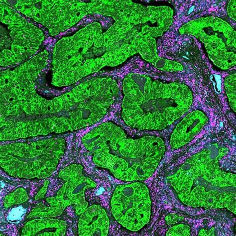 NanoString Spatial Transcriptomics 的图像结果