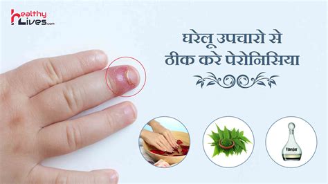 Home Remedies for Paronychia: नाखूनों का संक्रमण ठीक करने के घरेलू उपचार