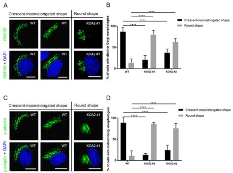 SLC35A2 Deficiency Promotes an Epithelial-to-Mesenchymal Transition ...