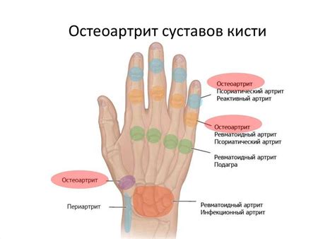 немеют пальцы большой и указательный на правой руке причины лечение