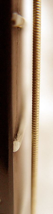 Image result for String ENT