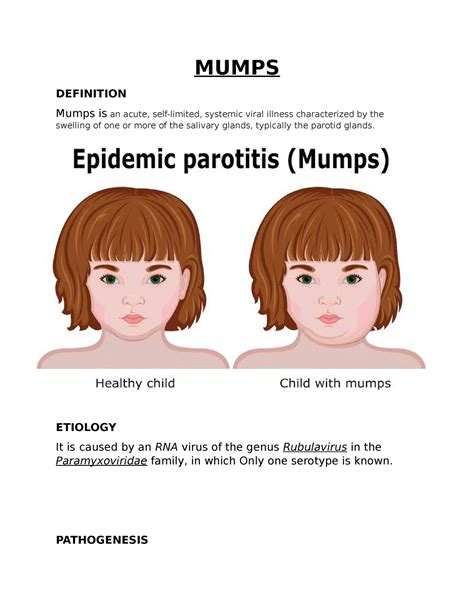 Mumps - MUMPS DEFINITION Mumps is an acute, self-limited, systemic ...