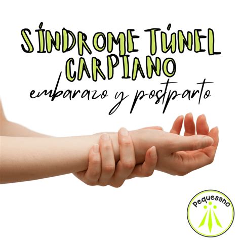 Síndrome del túnel carpiano en el embarazo y postparto