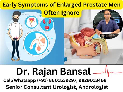 Alpha-Blockers in Urology: Comparative Efficacy in LUTS and Their Use ...