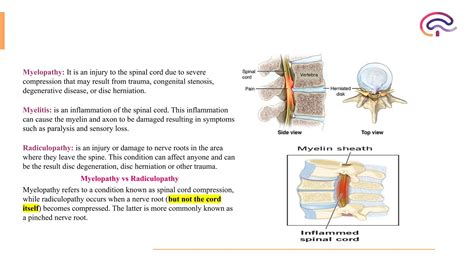 spinal cord disorders (Myelopathies and radiculoapthies) | PPTX