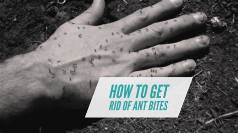 How To Get Rid Of Ant Bites: 12 Effective Ways