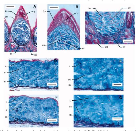 urethral caruncle | Semantic Scholar