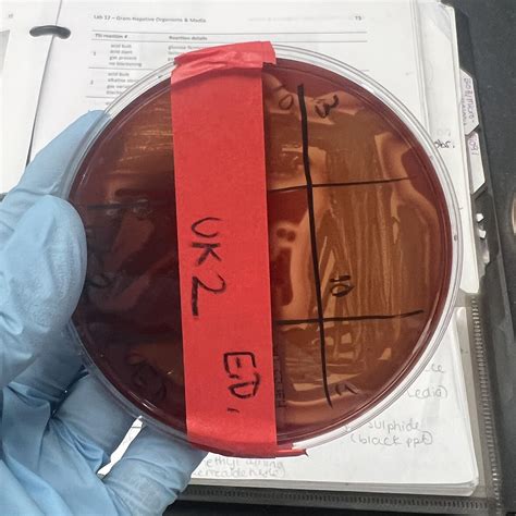 Alpha Beta Gamma Hemolysis