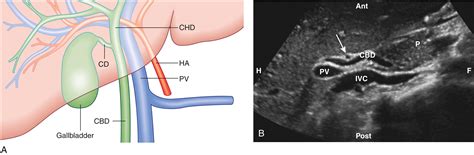 Ultrasonography: Understanding the Principles and Its Uses in Abdominal and Pelvic Imaging ...