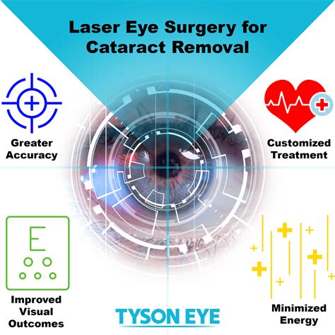 Modern Cataract Care with Laser Eye Surgery at Tyson Eye - Tyson Eye