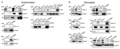 Expression and Localization Profiles of Tight Junction Proteins in ...