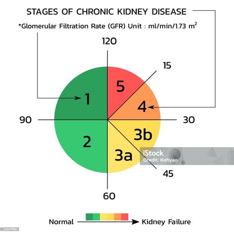 Glomerular Filtration Rate Gfr Vector向量圖形及更多健保和醫療圖片 - iStock