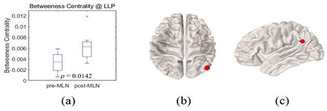 Comparison Analysis between the Medication Efficacy of the Milnacipran ...
