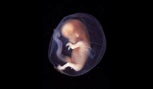胎生 的图像结果
