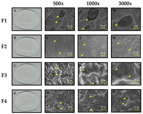 Development of Clindamycin-Releasing Polyvinyl Alcohol Hydrogel with Self-Healing Property for ...