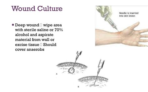 PPT - Specimen Collection PowerPoint Presentation, free download - ID ...