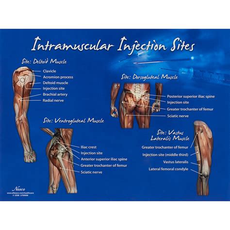 Intramuscular Injection 的图像结果