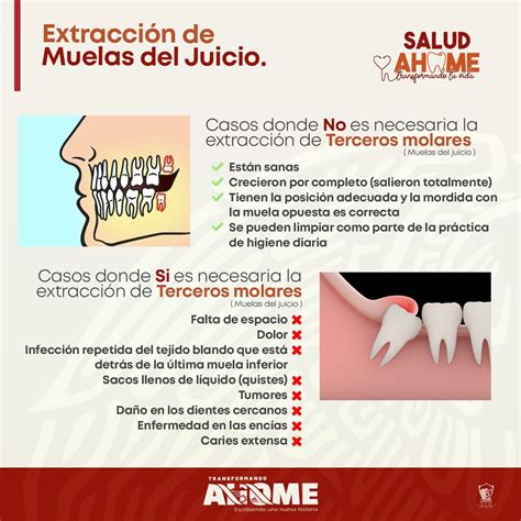 Arriba 90+ Foto 5 Plantas Medicinales Para El Dolor De Muela El último