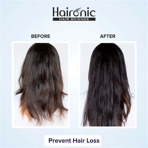 Buy HAIRONIC CAFFEINE STIMULATING SCALP TREATMENT HAIR SERUM 100ML ...