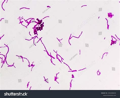 Stain Gram Streptococcus