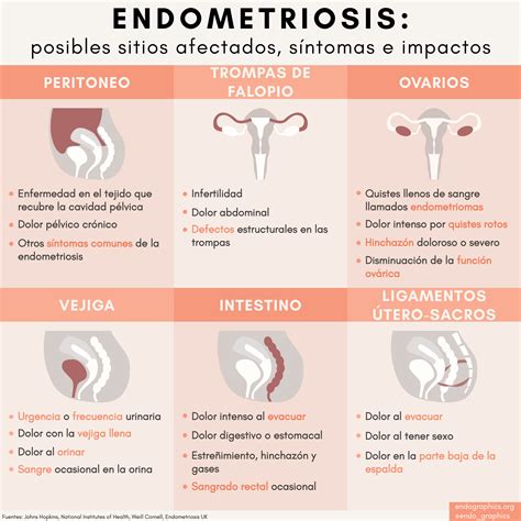 Endometriosis: Sitios Afectados y Síntomas — Endographics