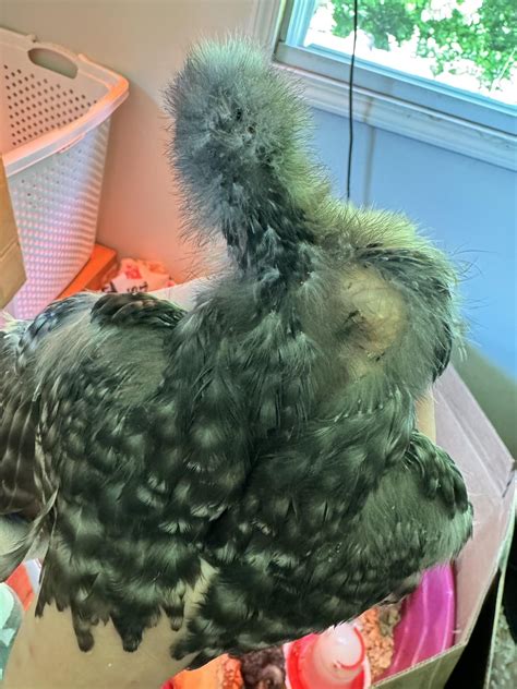 Lump On Side Of Neck