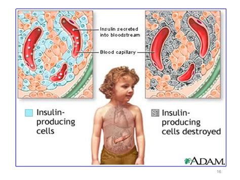 Endocrine pathology ( diabetes mellitus and thyroid gland ) | PDF