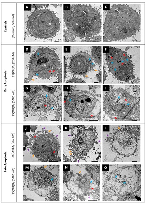 Induction of Cell Death and Regulation of Autocrine Vitamin D ...