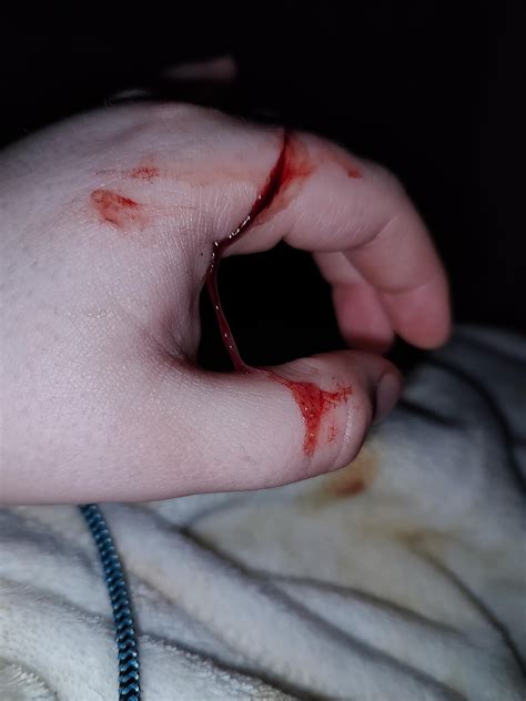 This came out when I blew my nose (haven't had a nosebleed in months and it didn't bleed) should ...