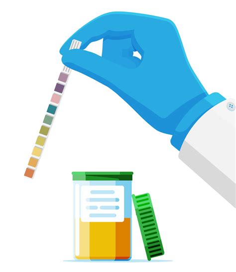 Hand of Doctor Holding Urine PH Test Strip in Jar Isolated. Laboratory ...