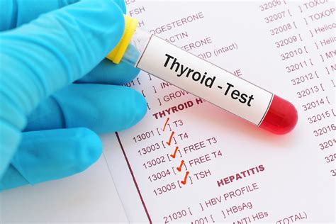 THYROID FUNCTION TESTS (T3, T4, TSH) – Sunrise Diagnostic Laboratory