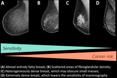 Diagnostics | Special Issue : Breast Imaging