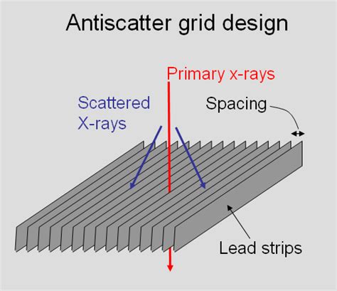 Scatter Removal Grids | Radiology | SUNY Upstate Medical University