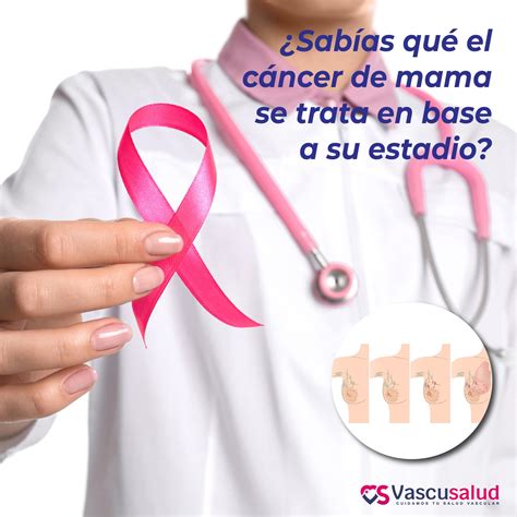 ¿Sabías qué el cáncer de mama se trata en base a su estadio?