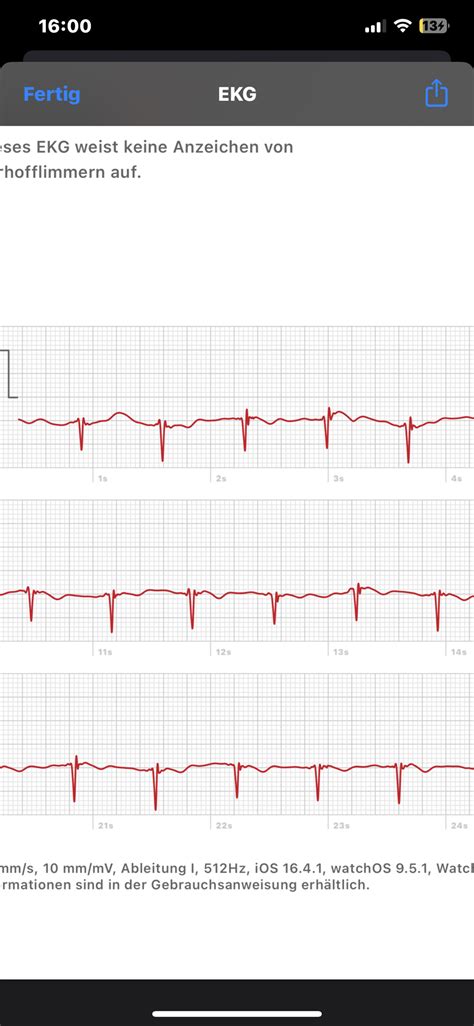 EKG Apple Watch am Knöchel? (Kardiologie)