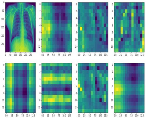 Bioengineering | Special Issue : Machine Learning for Biomedical ...