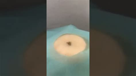 Image result for Large Pimples Exploding