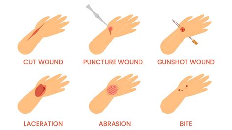 Doctor help types of injuries cut puncture gunshot bite laceration ...
