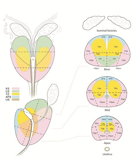 ACR | PI-RADS - Appunti di un giovane radiologo