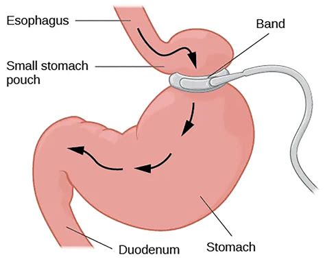Stomach Tutorial | Sophia Learning