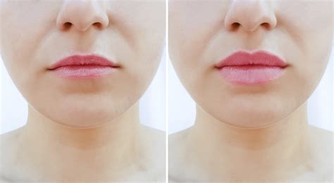How To Make Thin Lips Look Fuller Naturally