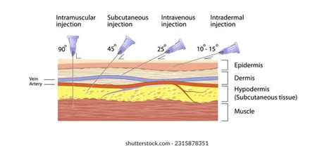 Injection Medicine 的图像结果