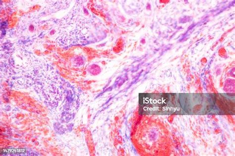 Image result for Finger Under Microscope